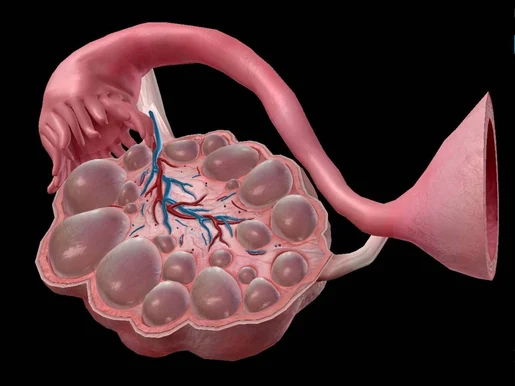 Homeopathic Treatment for Polycystic Ovarian Syndrome or PCOS