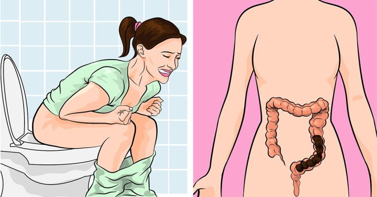 Homeopathic Treatments for Constipation